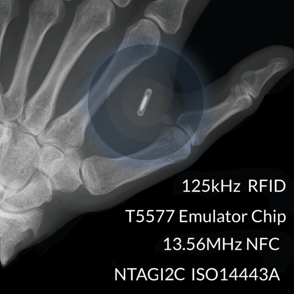 Radiografía de mano con implante de chip NFC/RFID T5577, NTAG I2C, 125kHz y 13.56MHz